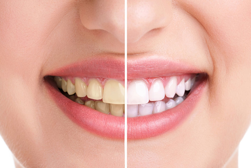 Estetica e cosmetica dentale